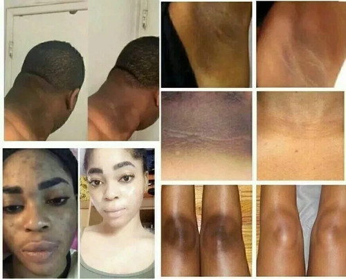 Skin lightening cream for - 2x,