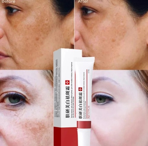 2pcs whitening freckle cream - whitening,