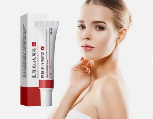 Whitening cream remove dark - whitening,