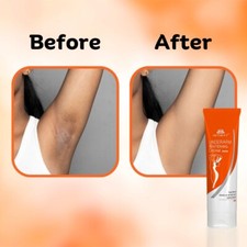 Underarm Whitening Cream for